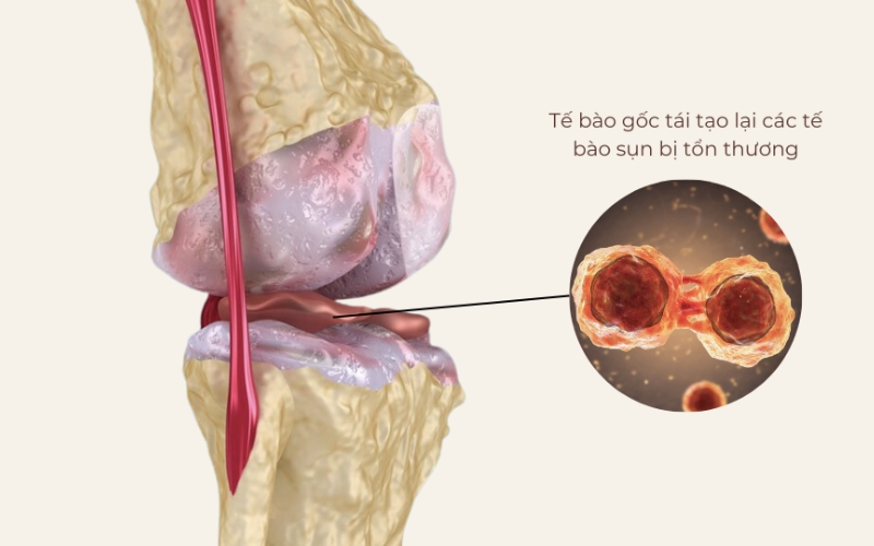 Tế bào gốc trưởng thành lấy từ đâu