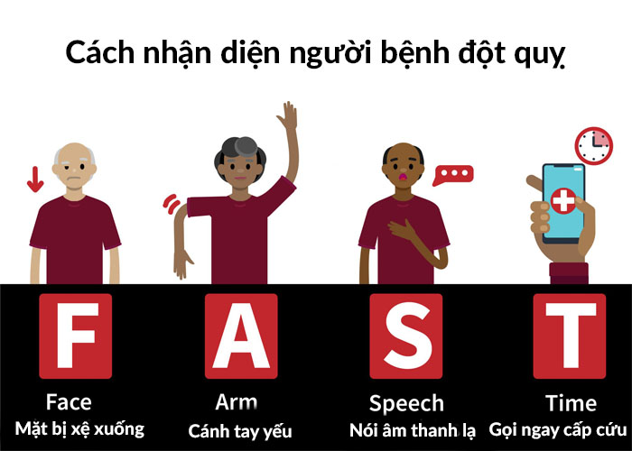 Quy tắc FAST trong đột quỵ