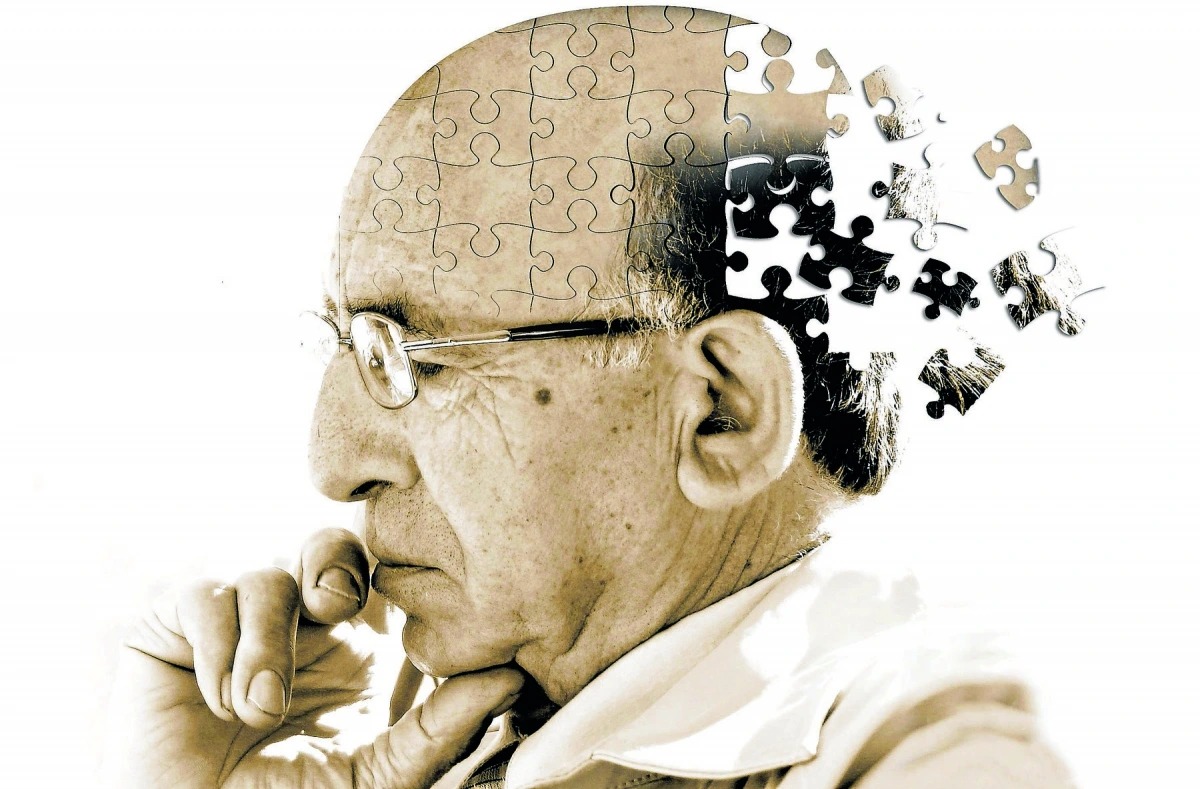 Triệu chứng bệnh Alzheimer - Cách điều trị Alzheimer