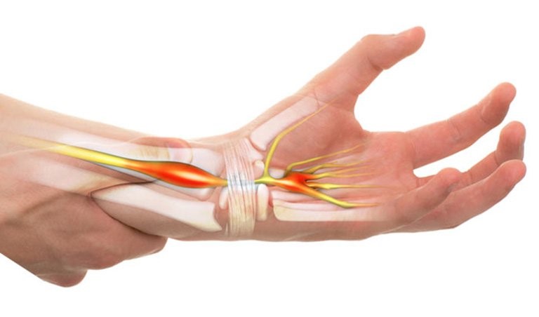 Các bệnh lý thường gặp liên quan đến thần kinh ngoại biên