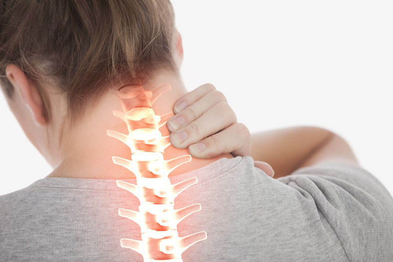 Chẩn đoán thoái hóa đốt sống cổ