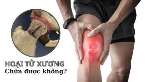 Hoại tử xương