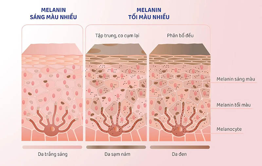 3 loại Melanin chính