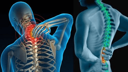 NMN trị gai cột sống theo hướng toàn diện