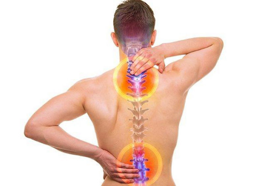 Bệnh gai cột sống do đâu? Dấu hiệu & cách điều trị