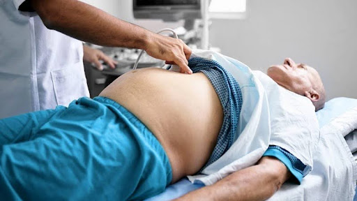 Bệnh nhân phù hợp điều trị xơ gan bằng tế bào gốc