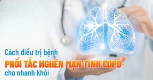 Phương pháp điều trị phổi tắc nghẽn mãn tính bằng tế bào gốc