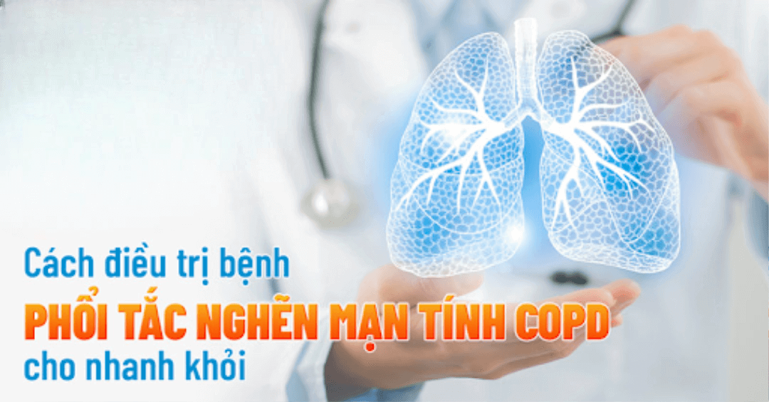 Phương pháp điều trị phổi tắc nghẽn mãn tính bằng tế bào gốc