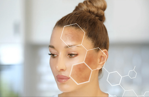 Cách làm giảm melanin trong da