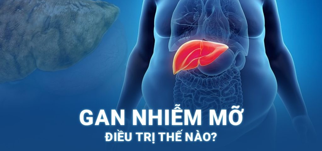 Điều trị gan nhiễm mỡ