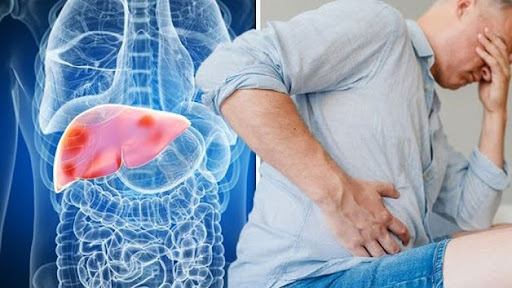 Điều trị xơ gan giới hạn trong việc “giữ bệnh không tiến triển”