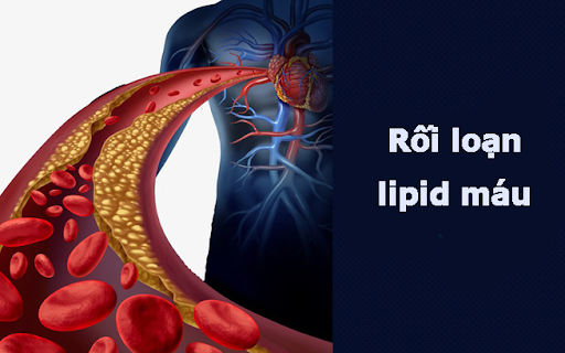 NMN: Hướng đi mới trong hỗ trợ cải thiện rối loạn lipid máu một cách tự nhiên