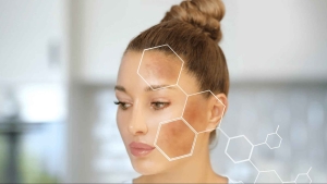 Sự phân bố của Melanin trong cơ thể