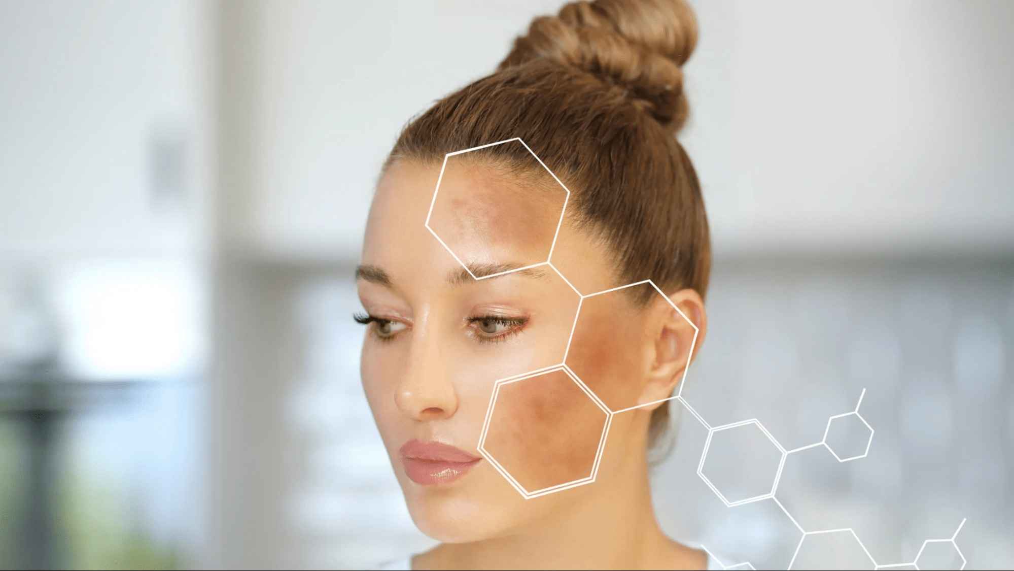 Sự phân bố của Melanin trong cơ thể