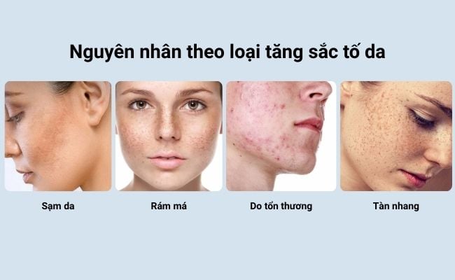 Nguyên nhân gây ra bệnh tăng sắc tố da