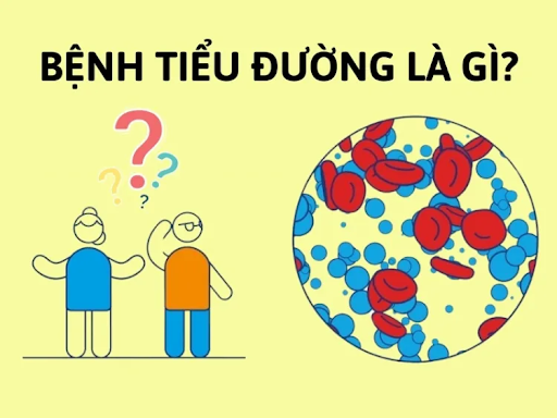 Tiểu đường là gì?