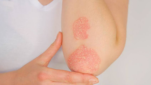 Trong nhiều thập kỷ, bệnh tự miễn được xem là căn bệnh mạn tính không thể chữa khỏi