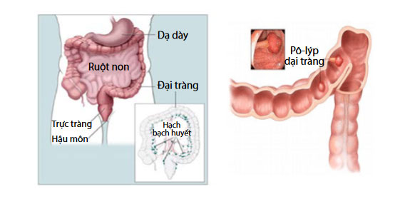 Phác đồ điều trị