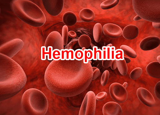 Bệnh hemophilia là gì?