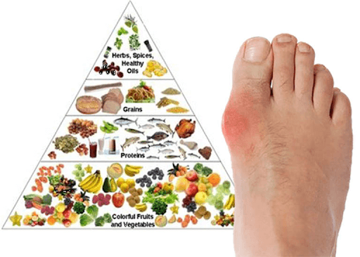 Cách ngăn ngừa và phòng chống bệnh gout