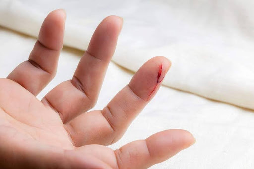 Chảy máu kéo dài bất thường
