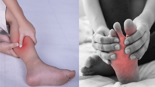 Chi phí điều trị bệnh teo cơ bằng tế bào gốc