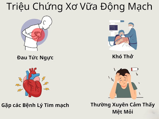 Dấu hiệu bệnh xơ vữa động mạch