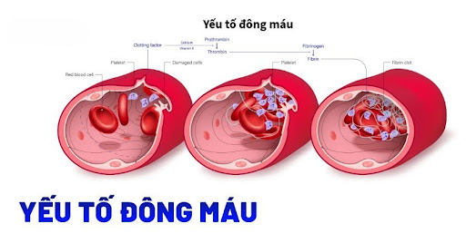 Liệu pháp thay thế yếu tố đông máu