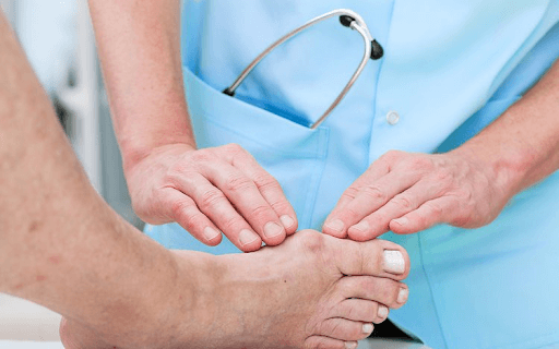 Lưu ý khi điều trị bệnh gout