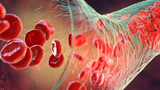 Nguyên nhân bệnh Hemophilia phổ biến