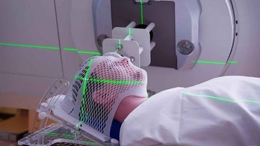 Xạ trị (Radiation Therapy)